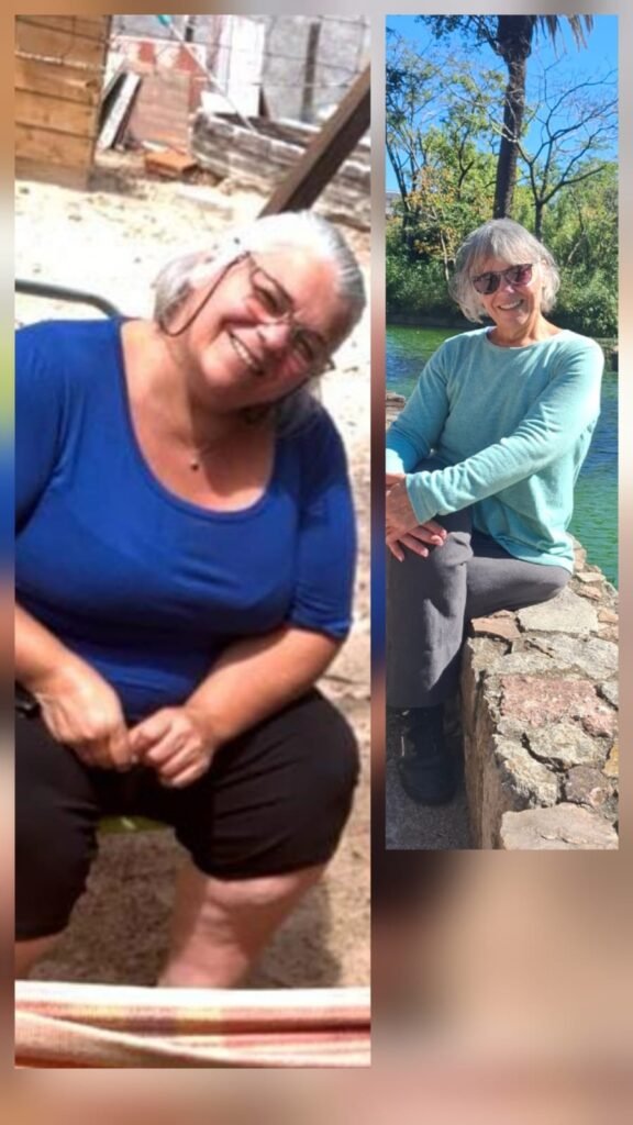 Inés y su experiencia con la cirugía bariátrica en CLIBA: un testimonio real de transformación, salud y esperanza